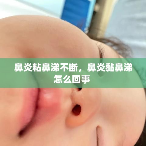 鼻炎粘鼻涕不断，鼻炎黏鼻涕怎么回事 
