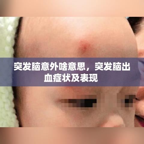 突发脑意外啥意思，突发脑出血症状及表现 